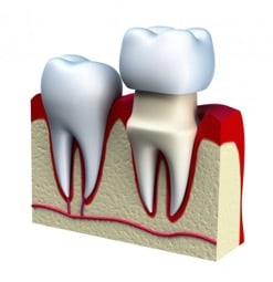 Dentist treating patient in Branford CT