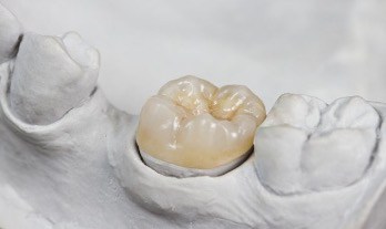 Dentist treating patient in Branford CT