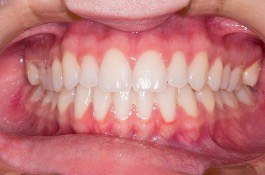 Dentist treating patient in Branford CT
