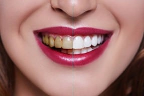 Dentist treating patient in Branford CT