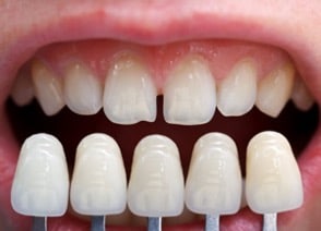 Dentist treating patient in Branford CT
